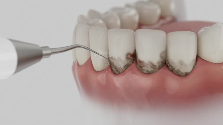 Trusted Emergency Dentist service in Fort Polk South, LA - Dentist Open Now